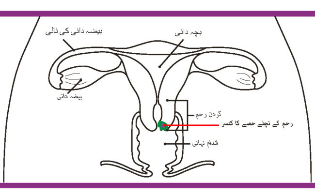 cervical cancer booklet_illustration_Page_01