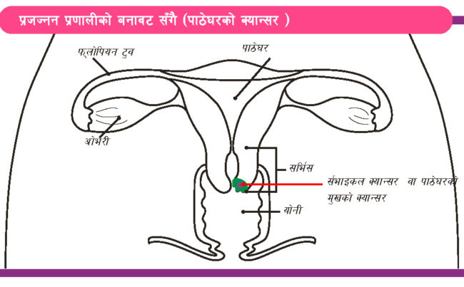 cervical cancer booklet_illustration_Page_01 cervical cancer booklet_illustration_Page_01